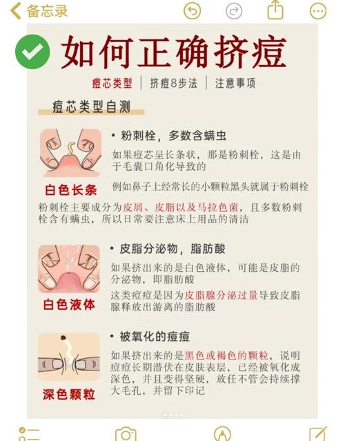 长期挤痘痘有哪些危害?忍不住想挤时可以这样做