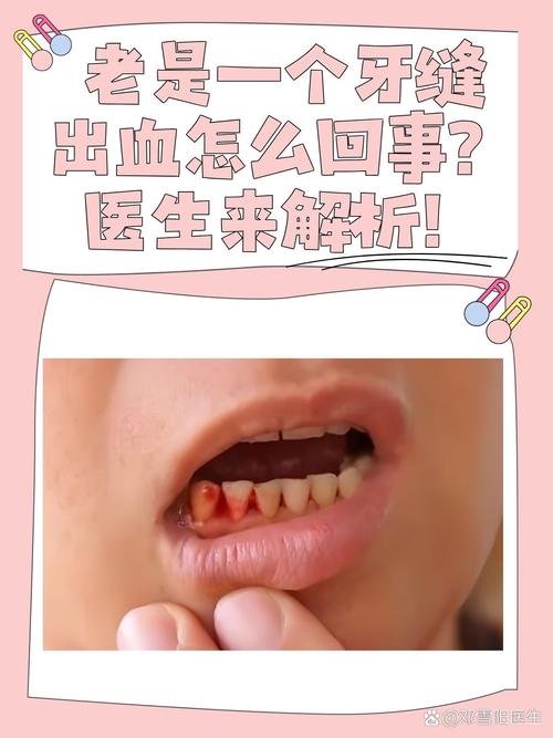 走路没力气,牙龈出血厉害,一查竟然是……