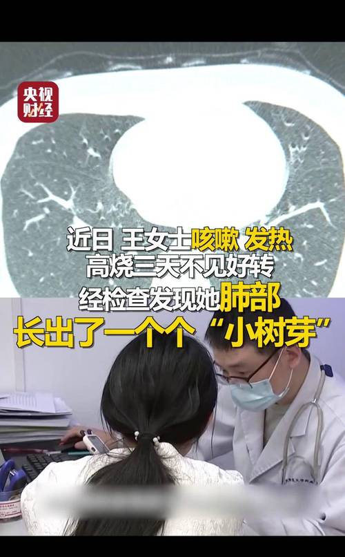“杭州姑娘清理发霉衣柜肺部长霉菌”登上热搜第一!网友:东西发霉还能碰吗?